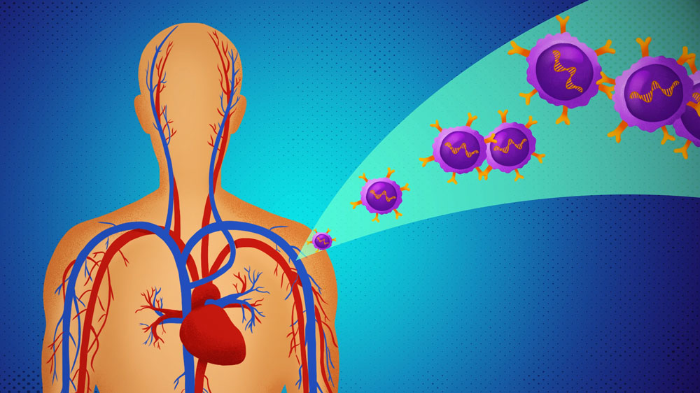 CAR-T-Cell-Therapy-c